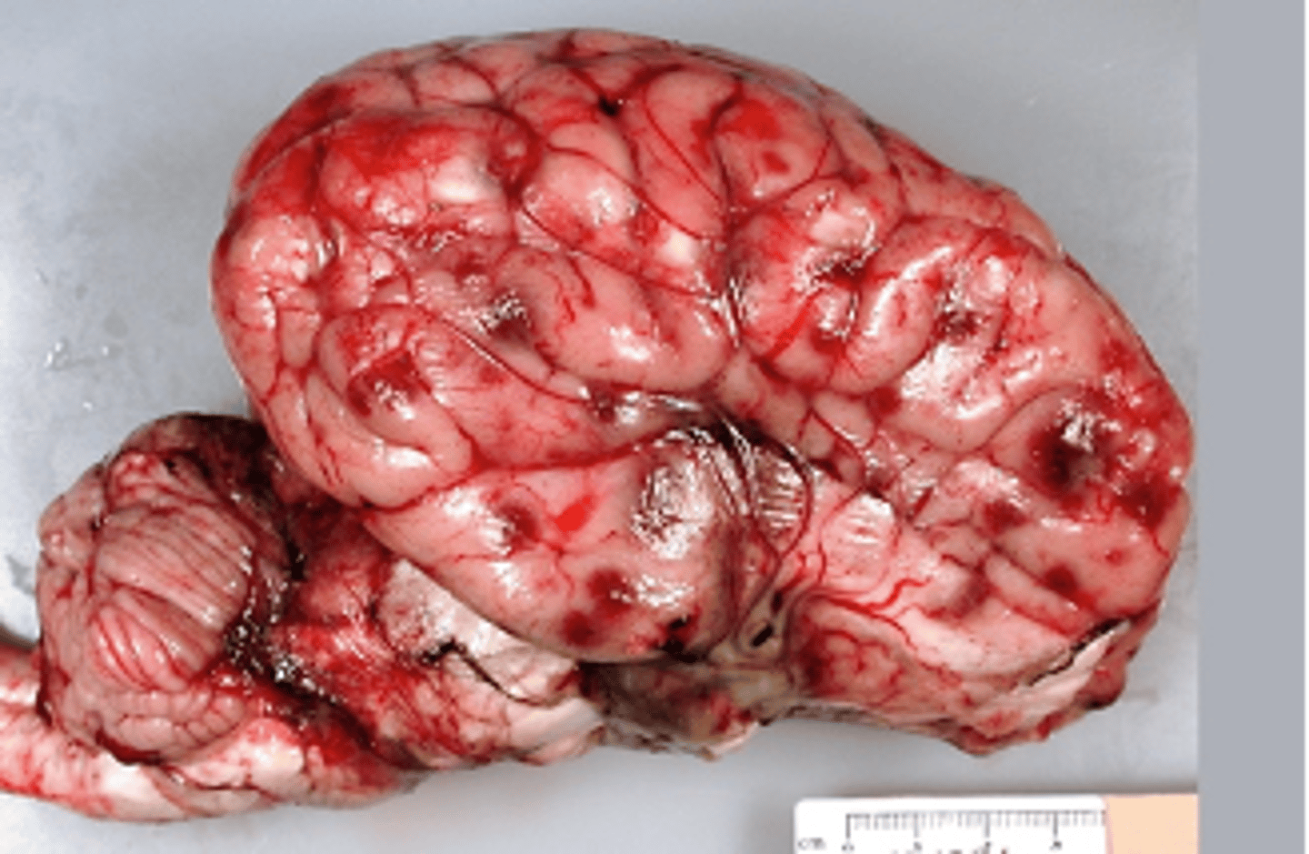 <p>based on the condition of this cows brain, it was likely suffering from what pathogens</p>