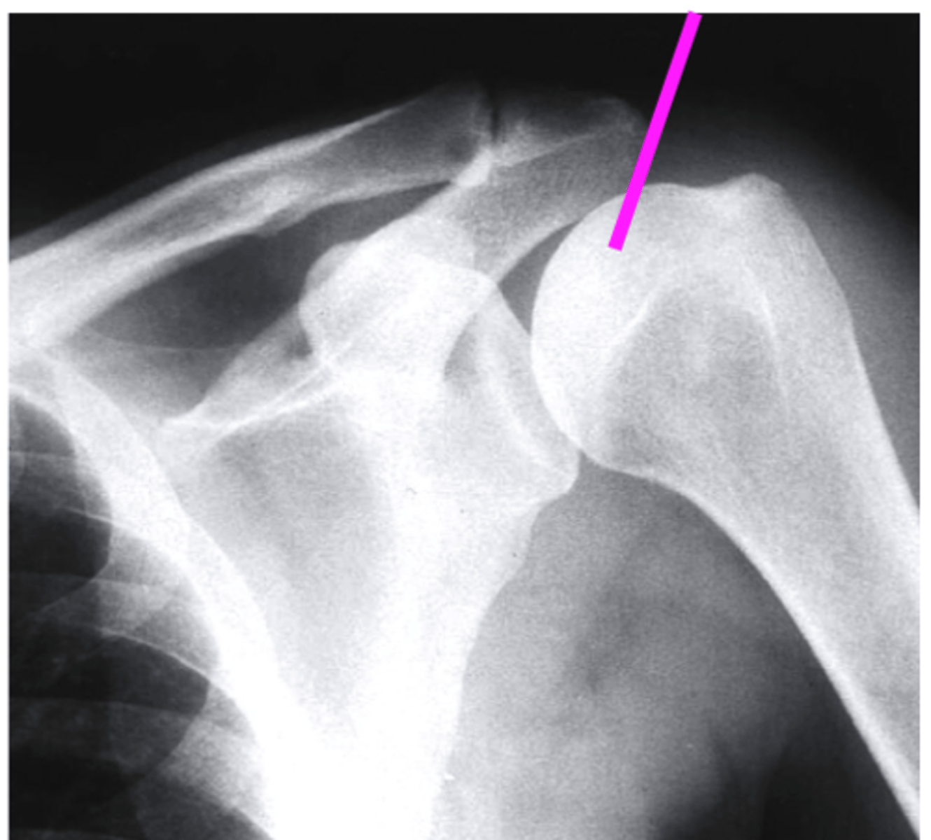 <p>what does the pink line point to?</p>