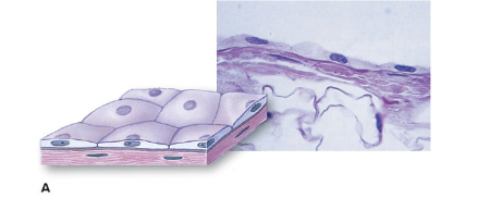 <p>flattened cells with broad and flat shape, one cell layer; facilitates movement of gases and other molecules (easier to traverse simple flattened cells)</p>