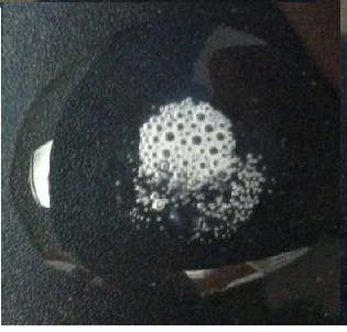 What are the results of this catalase test?