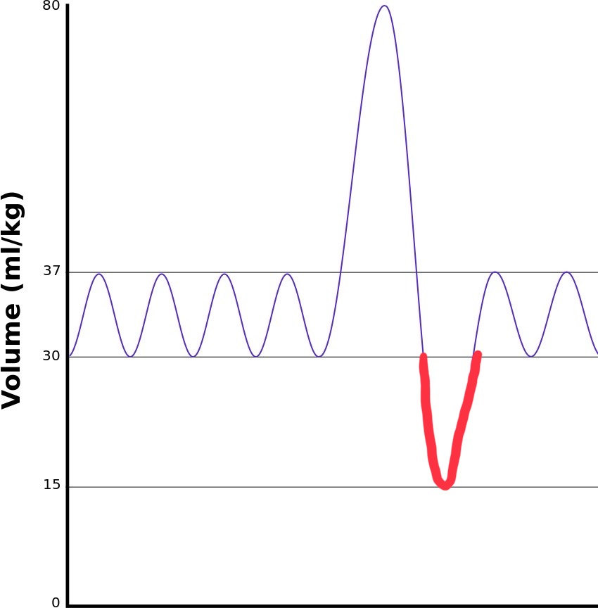 <p>The maximum amount of air you can forcibly exhale after tidal volume, typically 1100 mL</p>