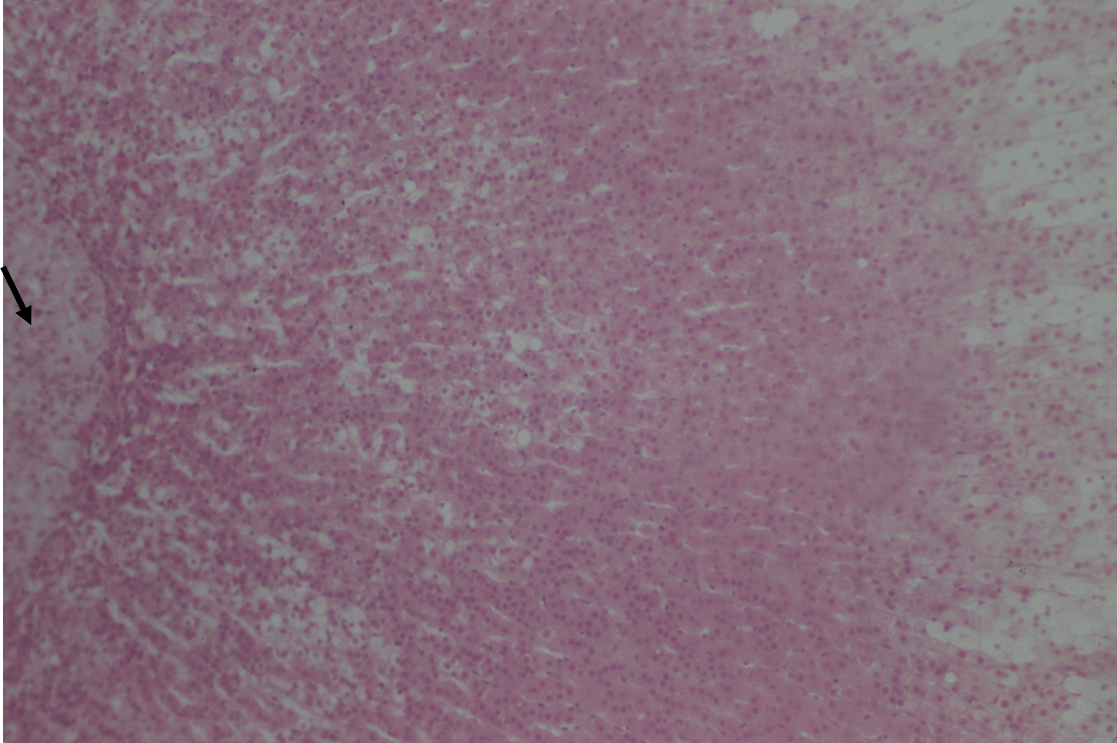 <p>Adrenal medulla</p>