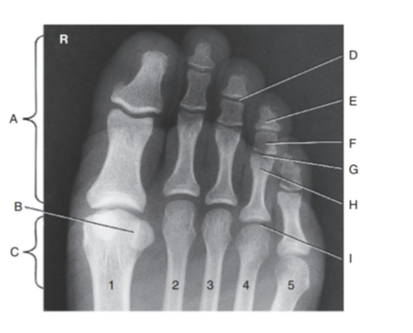 <p>(PA TOES) what is A?</p>