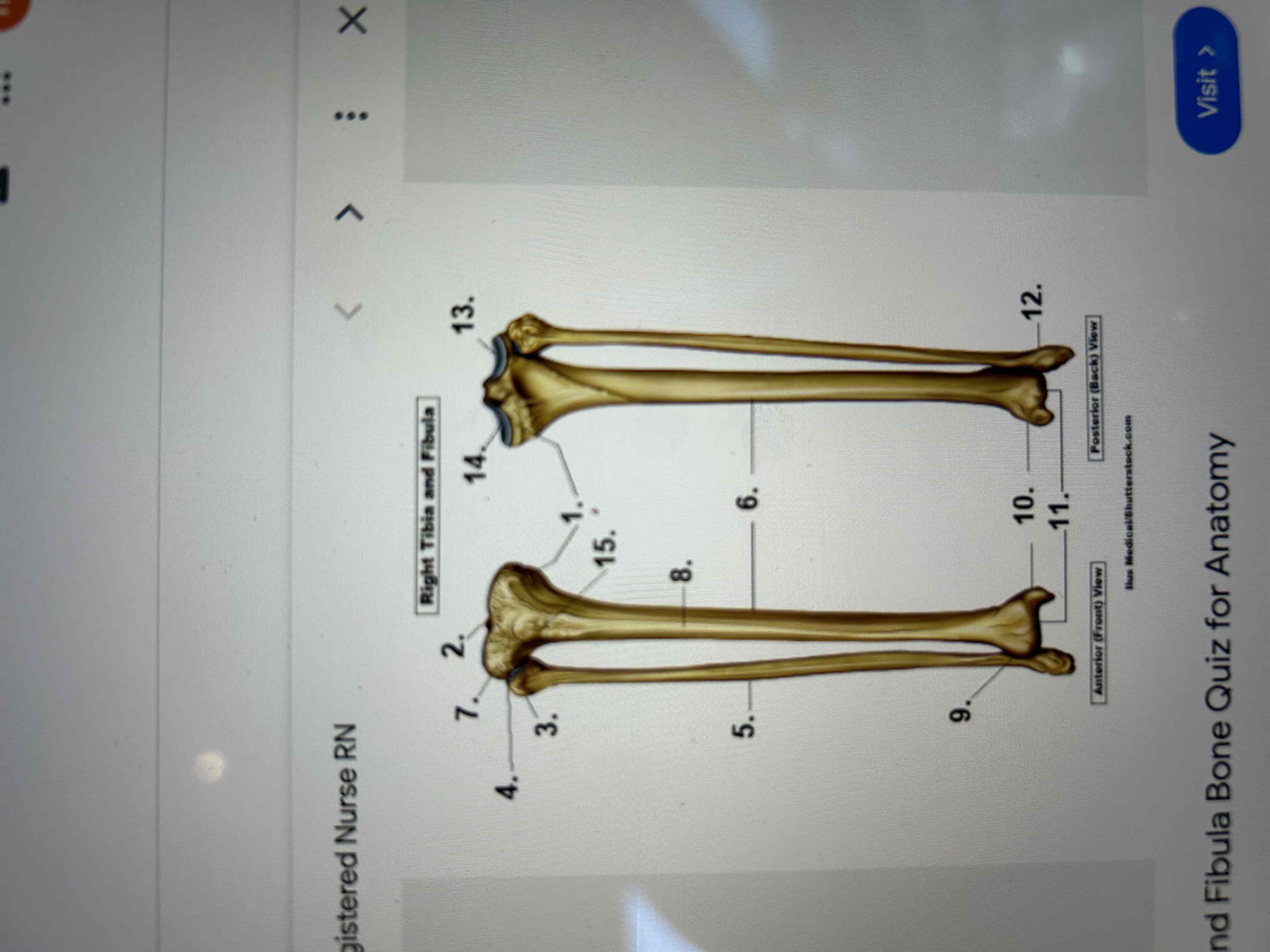 <p>Identify numbers 3,10,12 &amp;15</p>