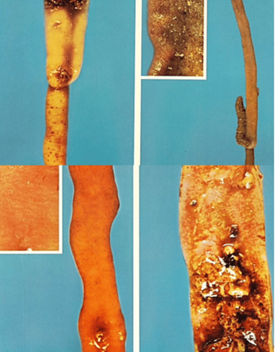 <p>Locates in the jejunum;</p><p>Small red petechiae on the serosal surface;</p><p>Orange colored mucus or blood clots;</p>