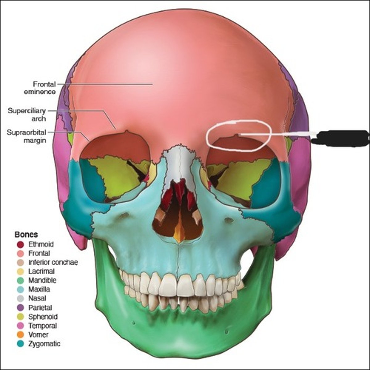 <p>Supraorbital foramen of the frontal bone</p>