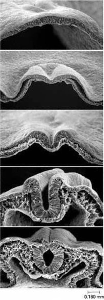 <p>The nervous system arises from a subset of ectodermal cells approximately 24 days after conception, forming a neural plate.</p>