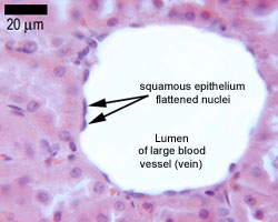 <p>Location: Body Cavities </p><p>Function: Rapid Diffusion </p>