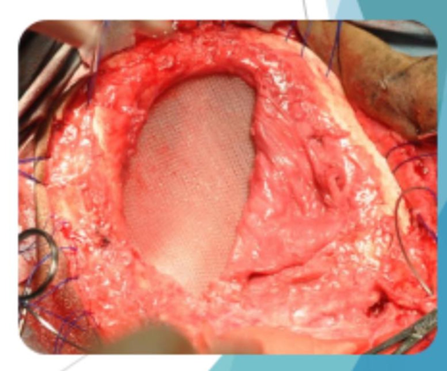 <p>What is being used here?</p>