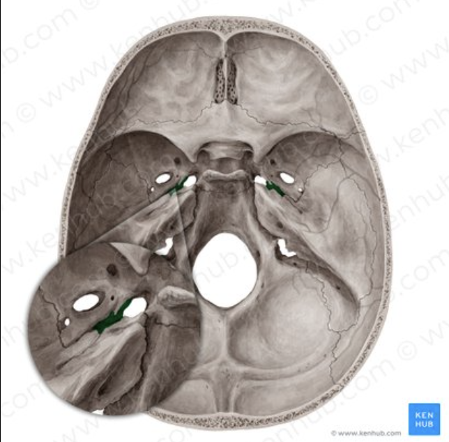 <p>What bone marking is this?</p>
