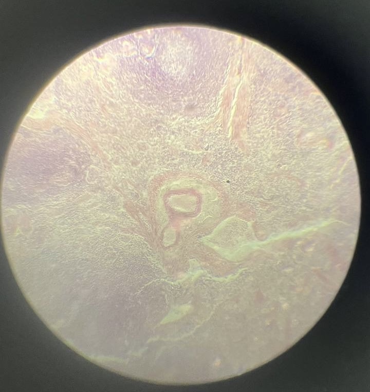 <p>Селезінка </p>