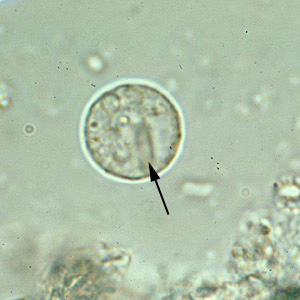 <p>Entamoeba histolytica cyst</p>