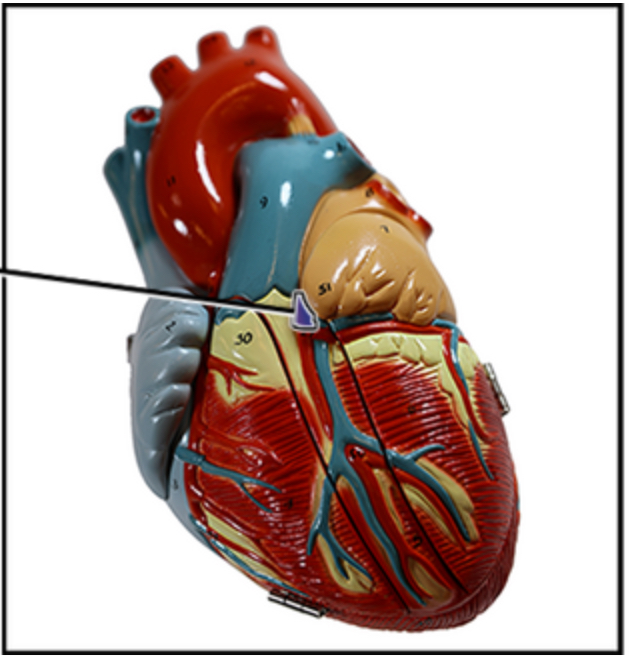 <p><span style="color: rgb(0, 0, 0);">Name this structure of the heart.</span></p>