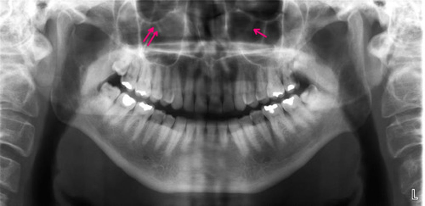 <p>Identify the structure.</p>