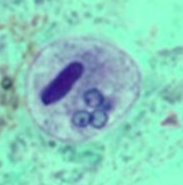 term image