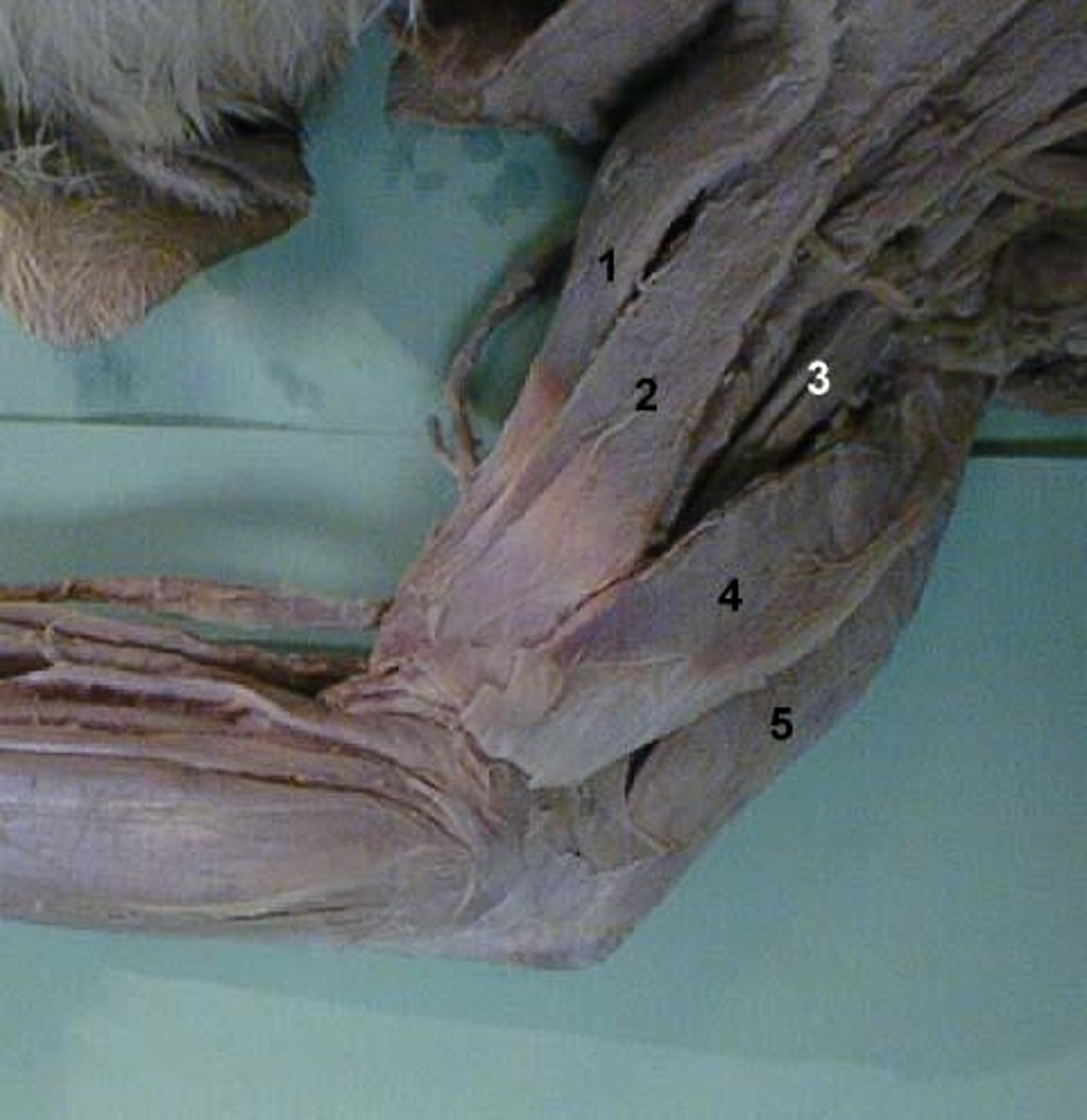 <p>O: distal posterior surface of humerus</p><p>I: olecranon process of ulna</p><p>A: extends forearm/elbow</p>