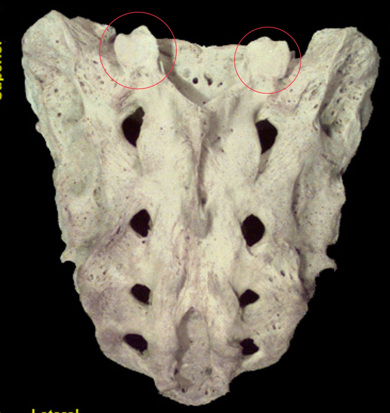 <p>What are these areas?</p>