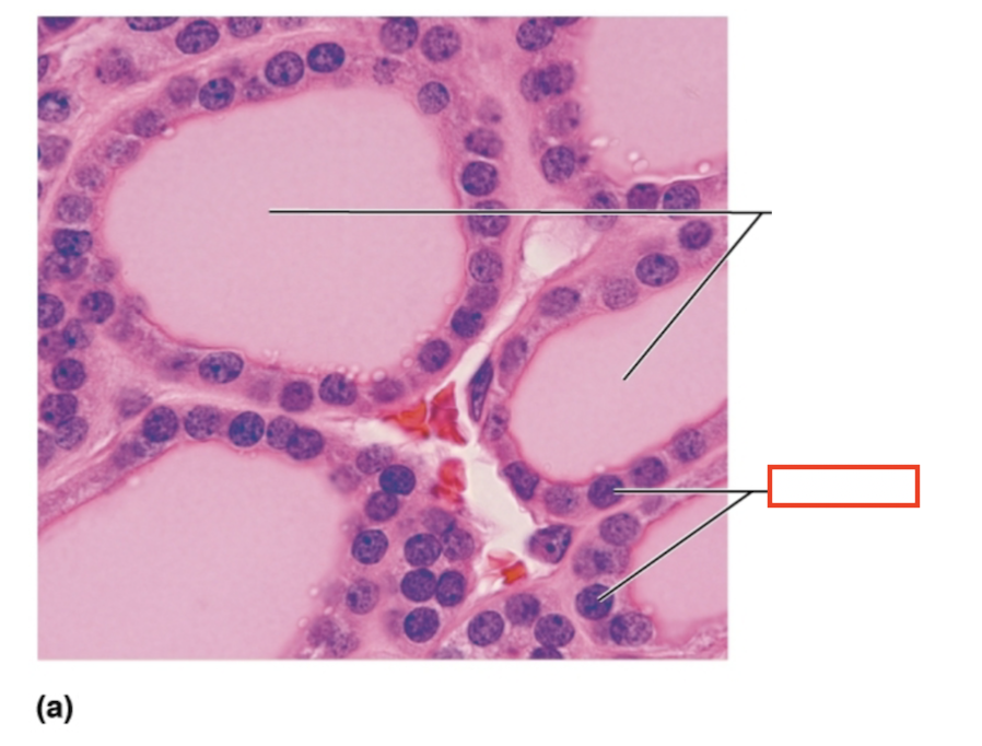 <p>What structure is highlighted?</p>