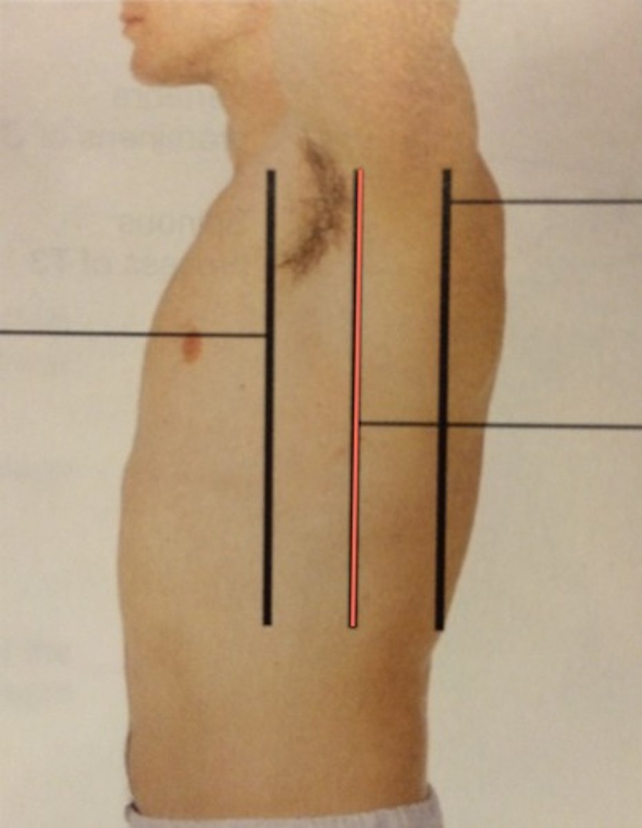 <p>An imaginary line thru the axillary area that divides the bod front &amp; back</p>