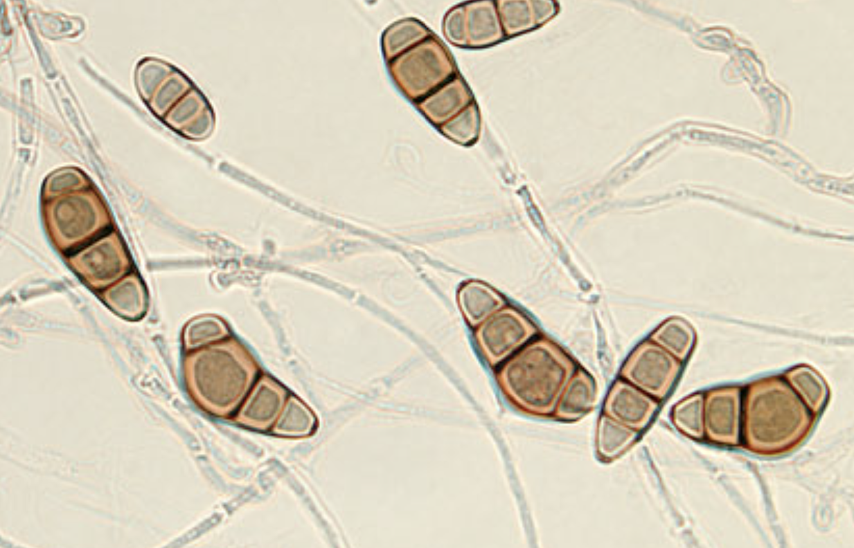 <p>What organism is this?</p>