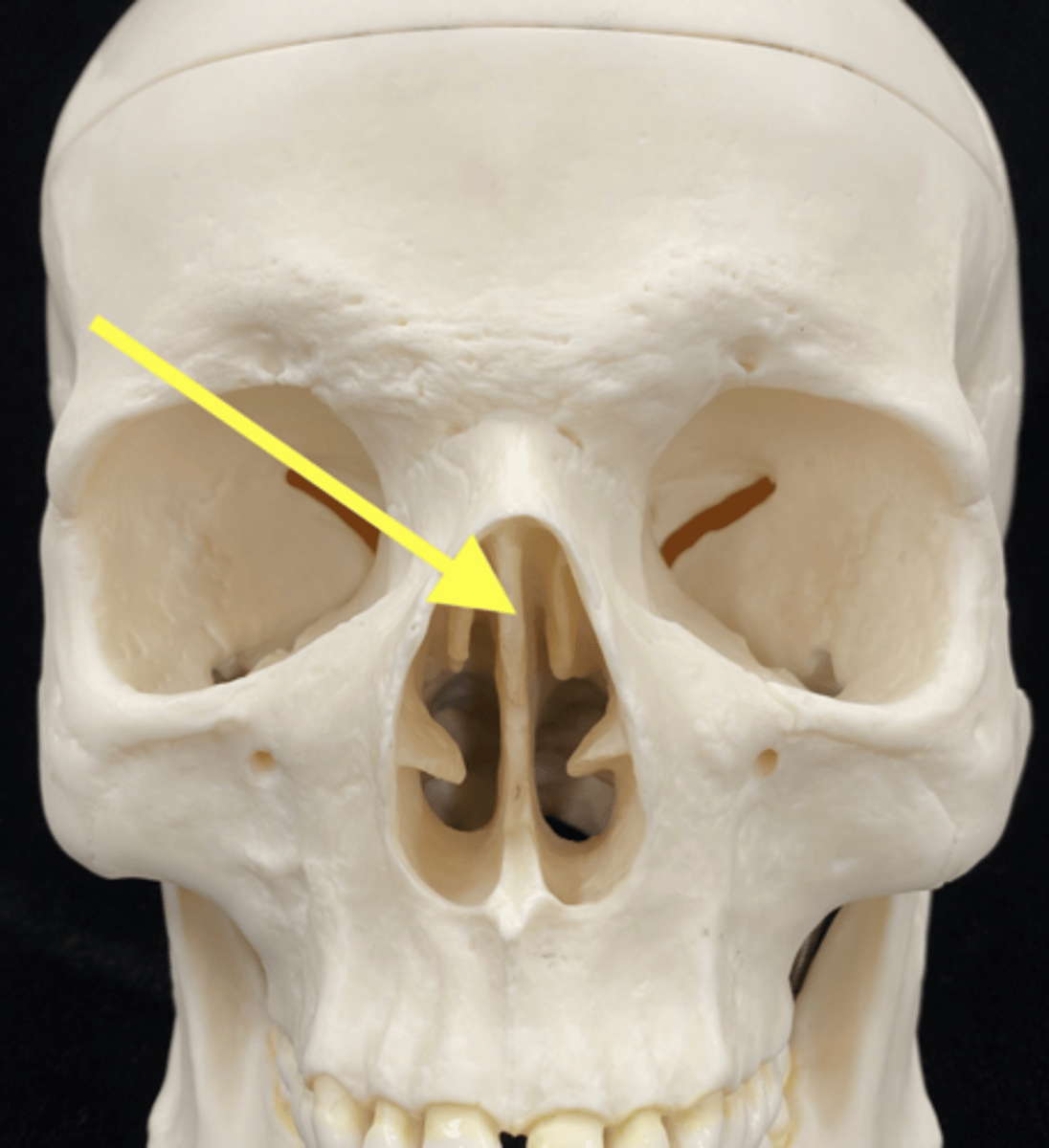 <p>name the bone and bone feature</p>