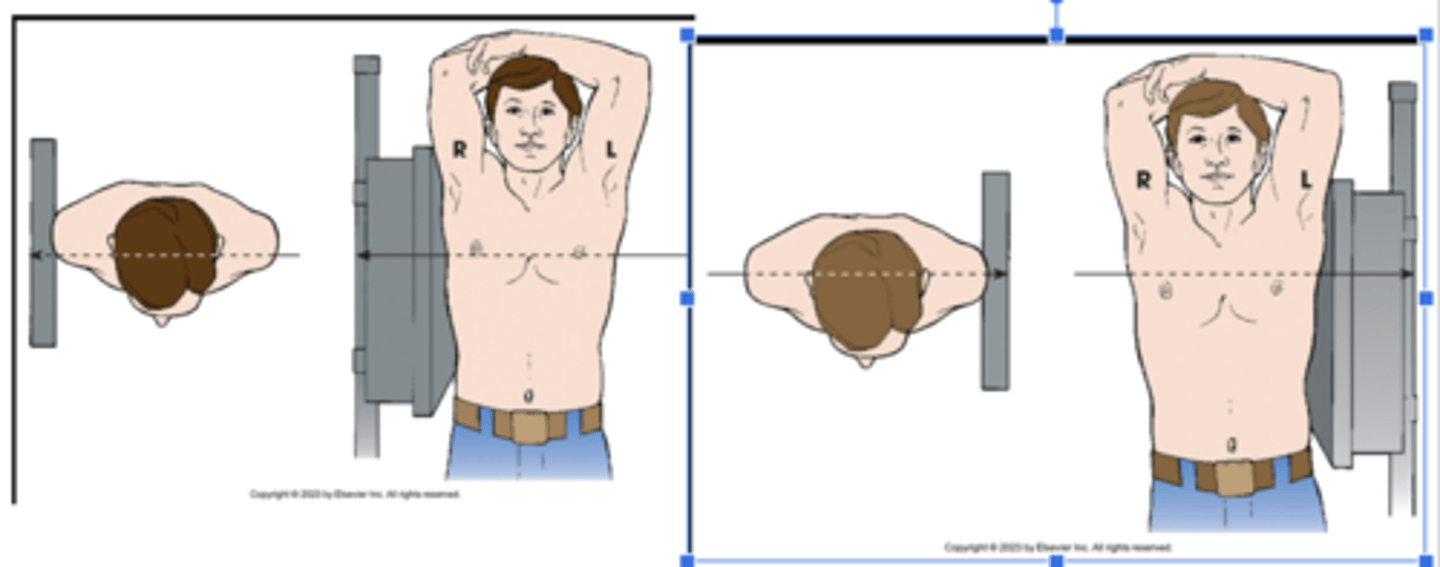 <p>ID the projection:</p><p>Right lateral radiographic position of chest results in X projection</p><p>Left lateral radiographic position of chest results in X projection.</p>