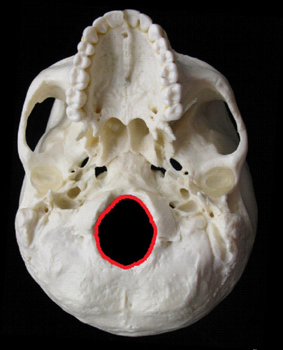 <p>large hole in the OCCIPITAL through which the brain stem passes inferiorly into the vertebral canal</p>