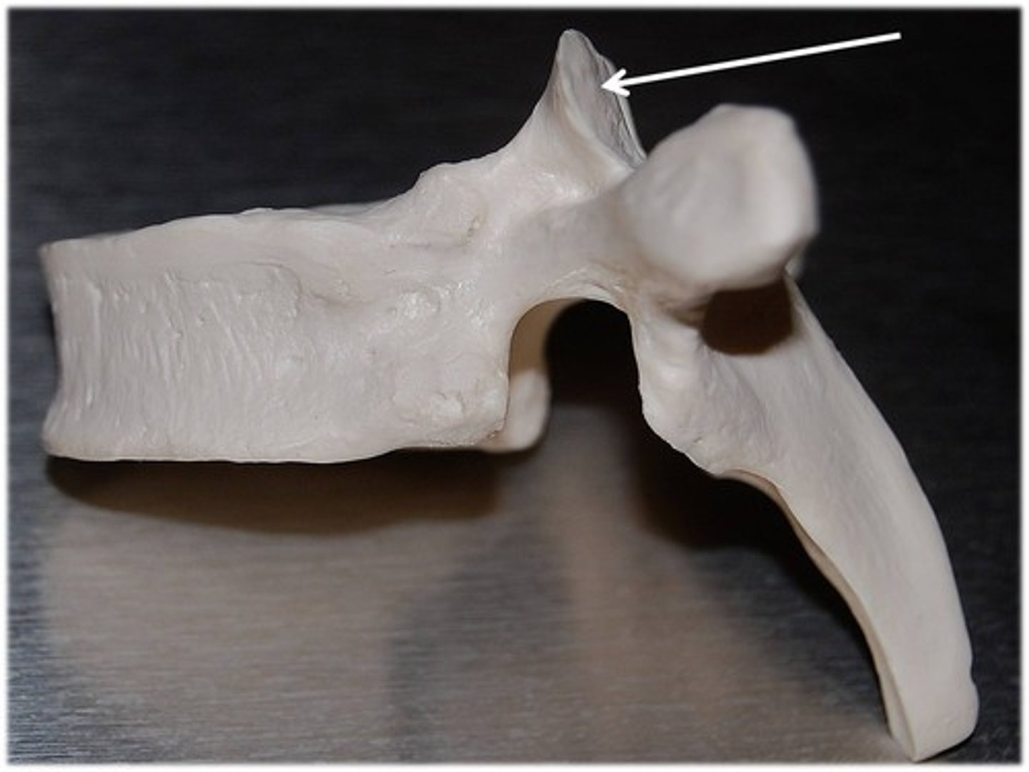 <p>the part of the superior articular process that articulates with the superior bone to it</p>
