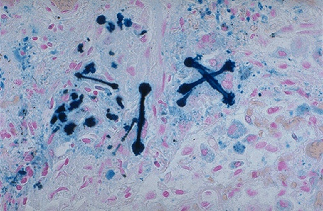 <p>PB</p>