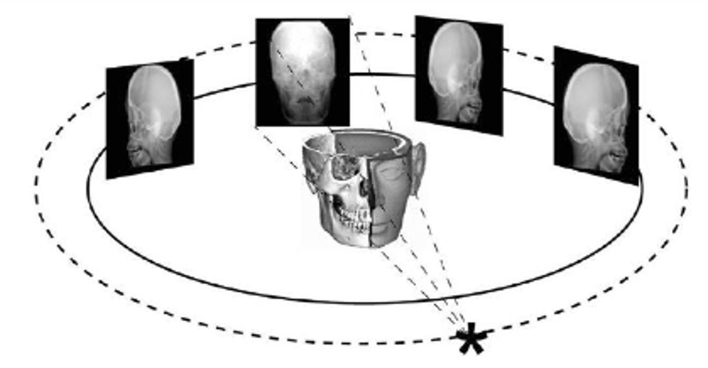 <p>allows accurate, three dimensional (3D) imaging of hard tissue structures</p>