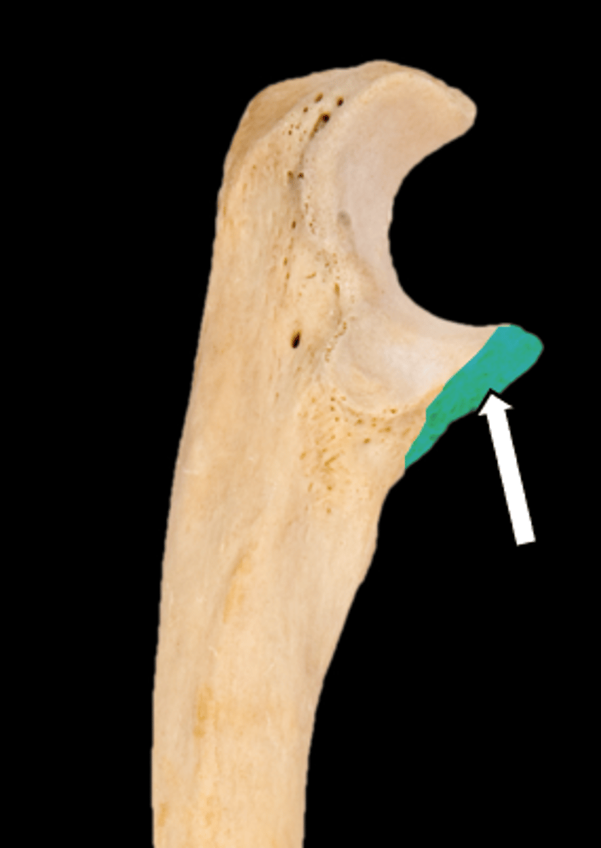 <p>name the part</p>