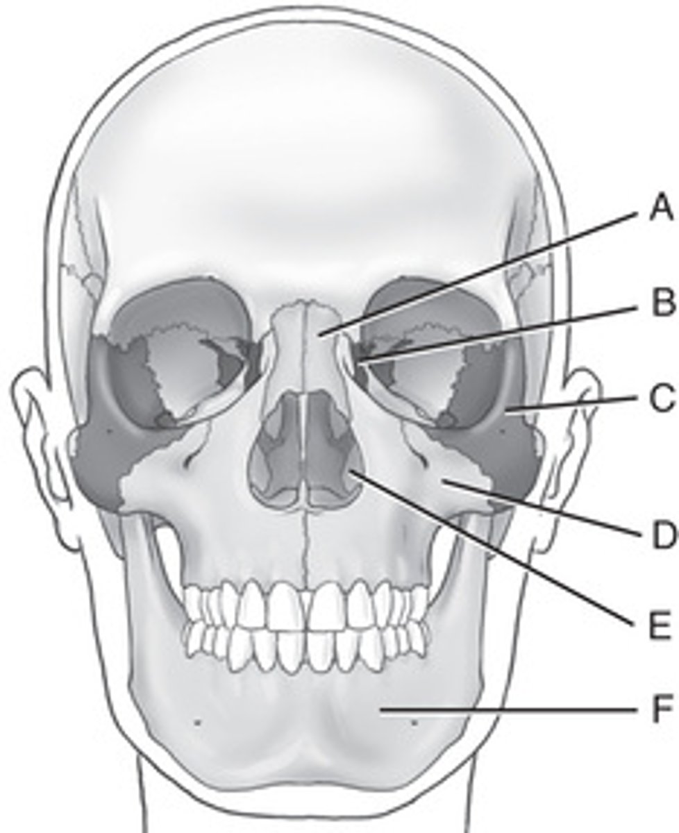 <p>A. Nasal bones</p><p>B. Lacrimal bones</p><p>C. Zygomatic bones</p><p>D. Maxillary bones</p><p>E. Inferior nasal conchae</p><p>F. Mandible</p>