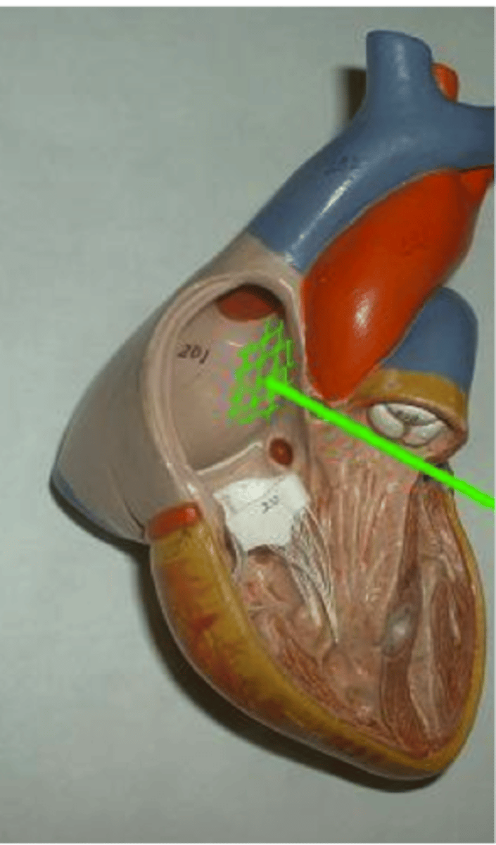 <p>Function: separate left and right atria</p>