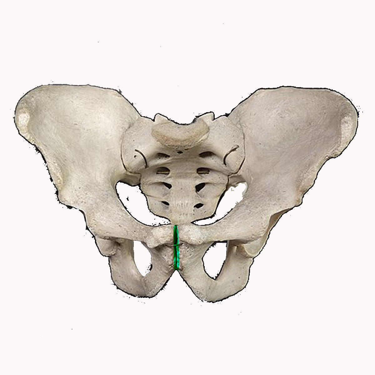 <p>Name the highlighted feature of the pelvis</p>