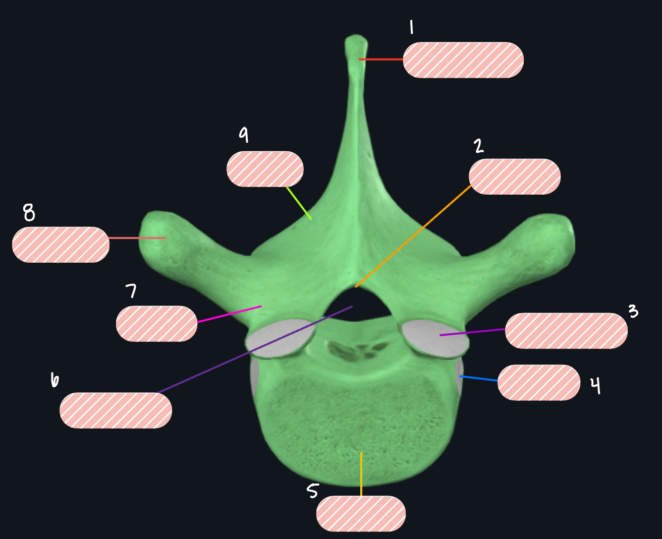 <p>What vertebra is this?</p>