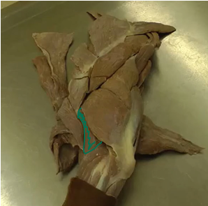 <p><span>Brachial Region (Arm)</span></p>