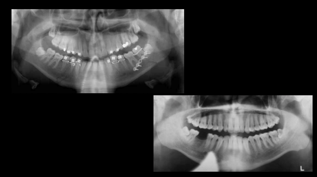 <ul><li><p>Image 1: Ghost image of a necklace/chain. Also jaw surgery.</p></li><li><p>Image 2: Lead apron</p></li></ul><p></p>