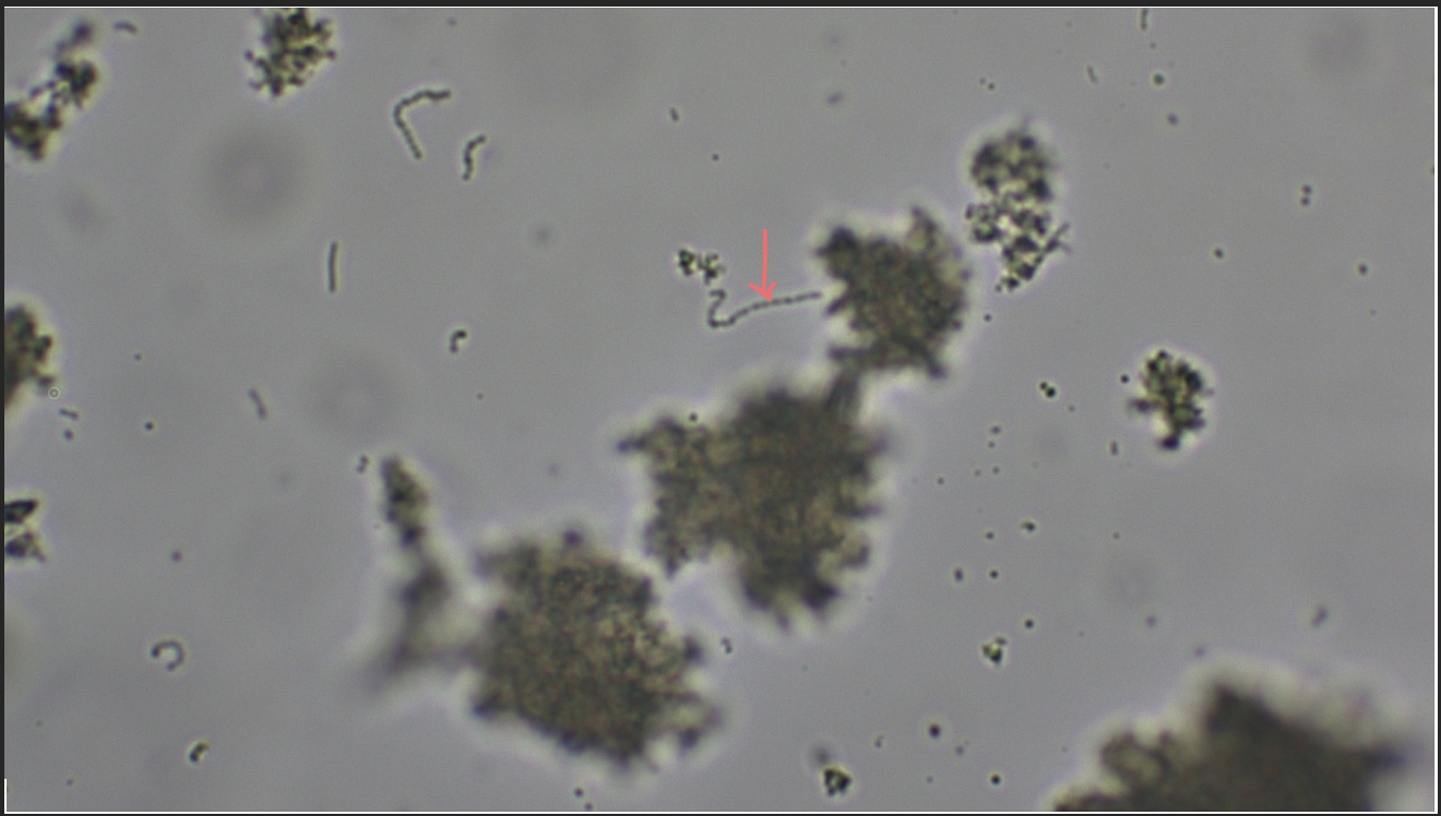 <p>Rod-shaped bacteria, nonmotile, chemoheterotroph, found in yogurt, helps partially digest proteins and milk solids</p>