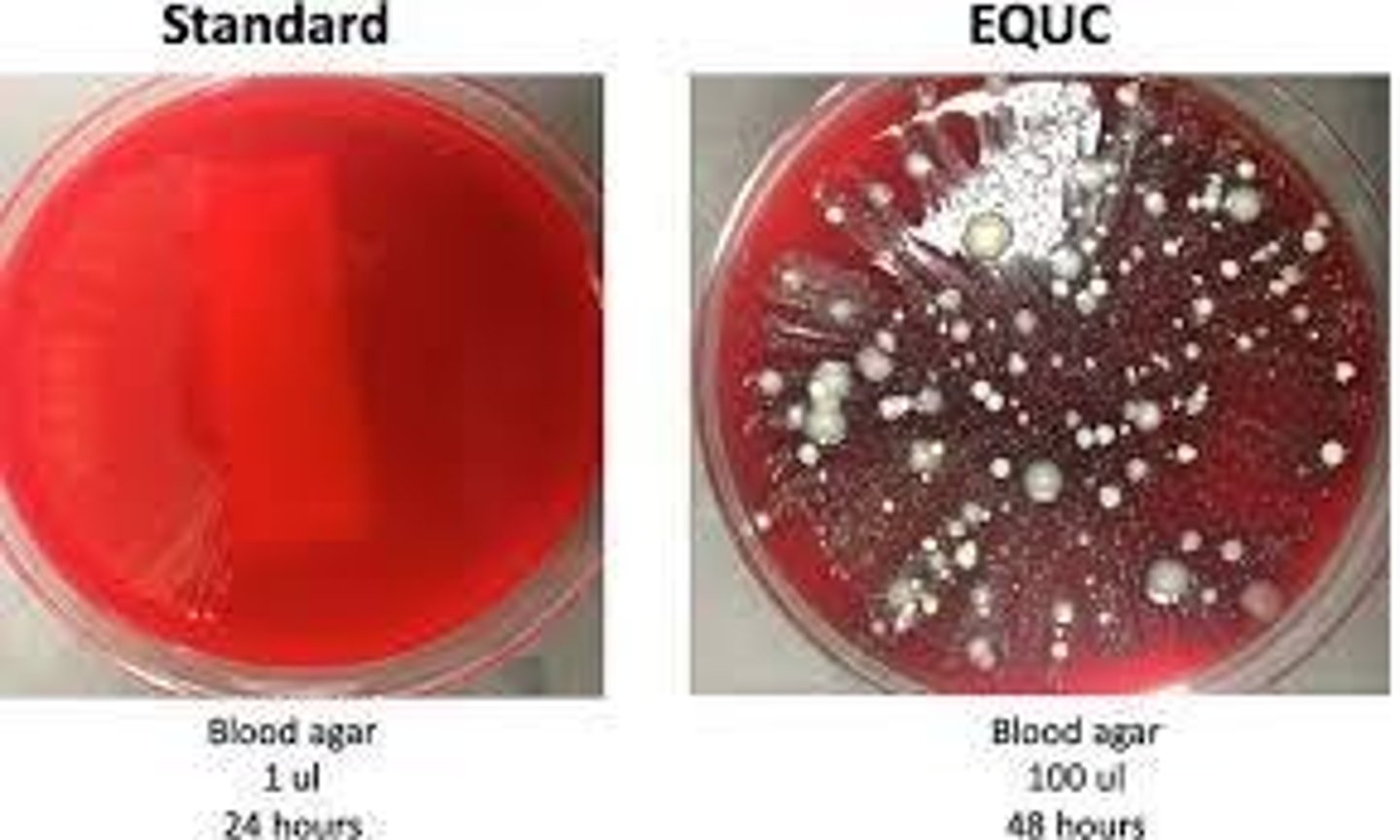 <p>Urinary Tract Infection (UTI)</p>