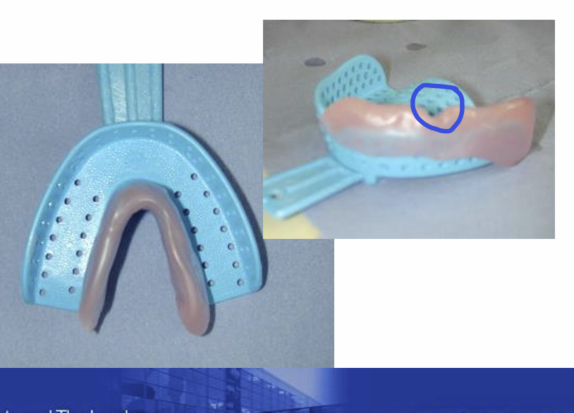 <p>What is the V shape for?</p>