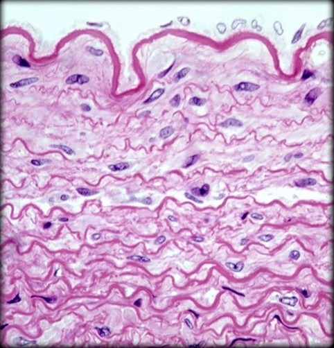 <p>What kind of Dense Connective Tissue is this? Where do you find it?</p>