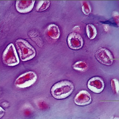 <p>hyaline cartilage</p>