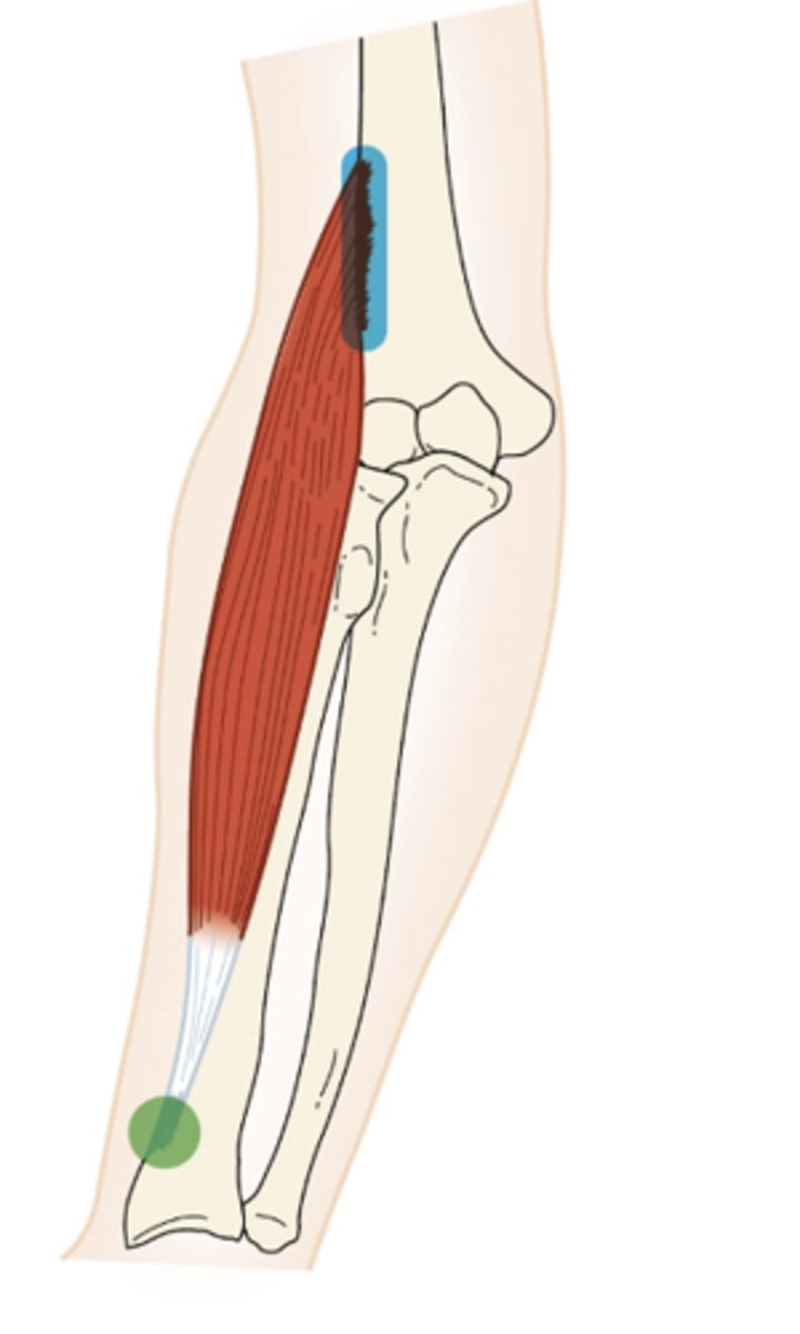 <p>What muscle is this?</p>