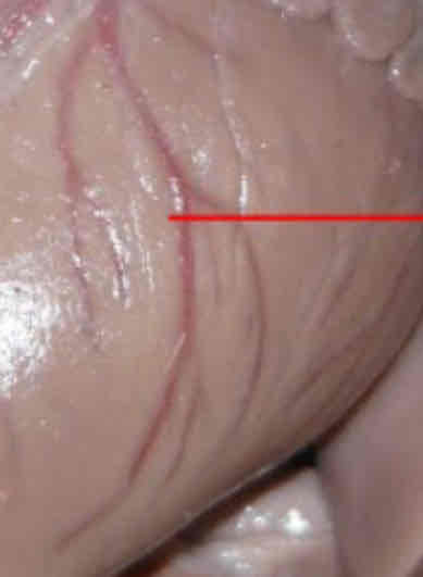 <p>Identify this structure</p>