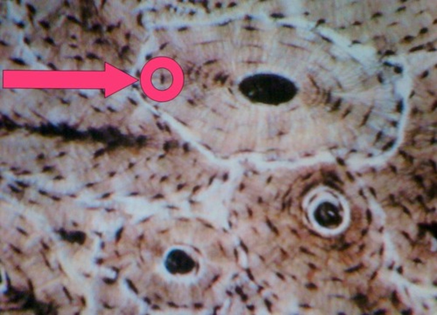 <p>mature bone cell formed from differentiation of osteoblasts; most abundant bone cells; maintain matrix by recycling calcium slats</p>