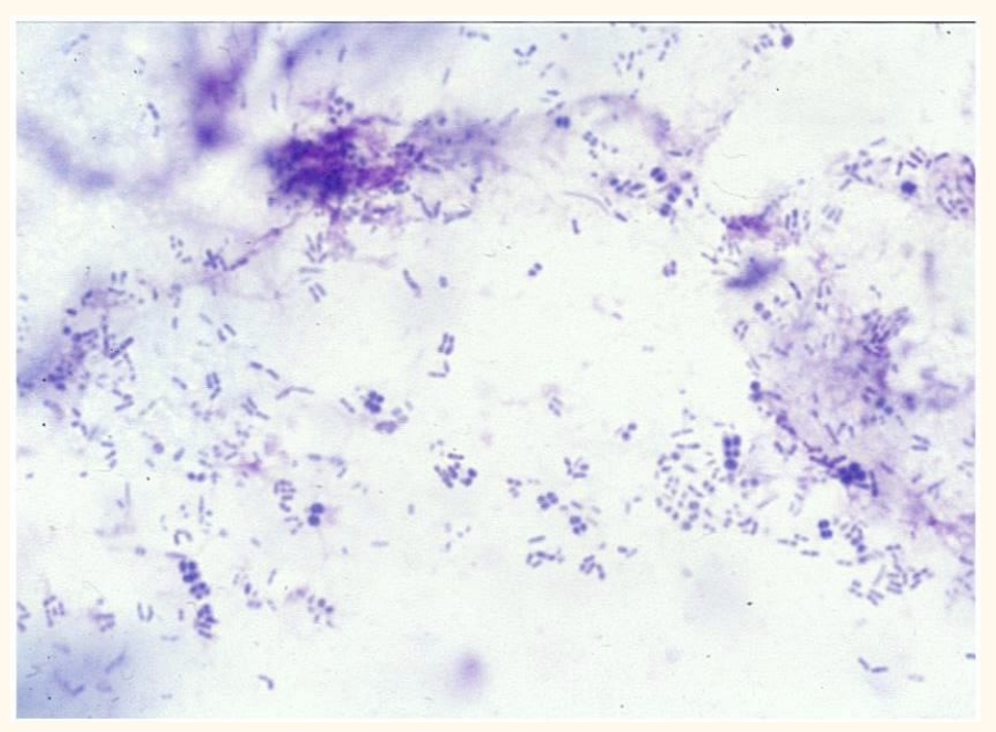 <p>Interpret this impression smear</p>