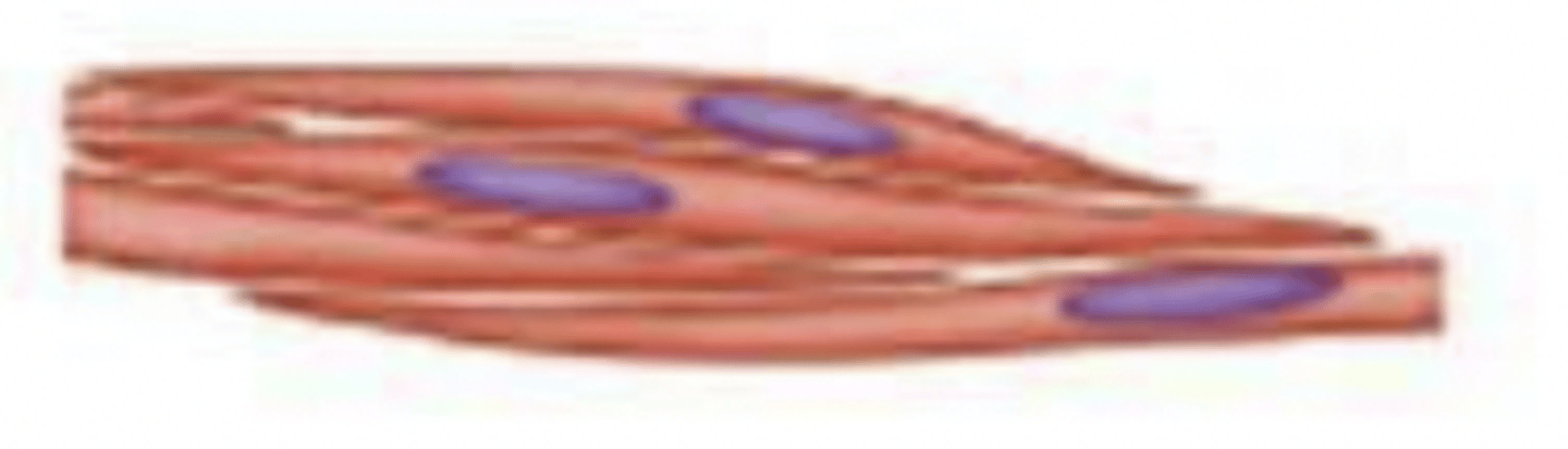 <p>what type of muscle tissue?</p>