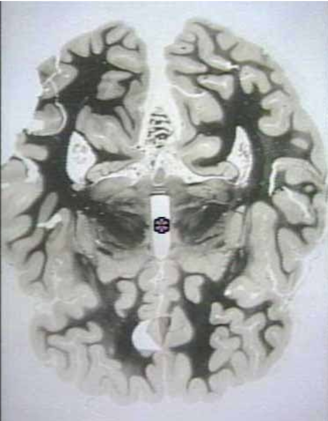 <p>What area is the star in?</p>