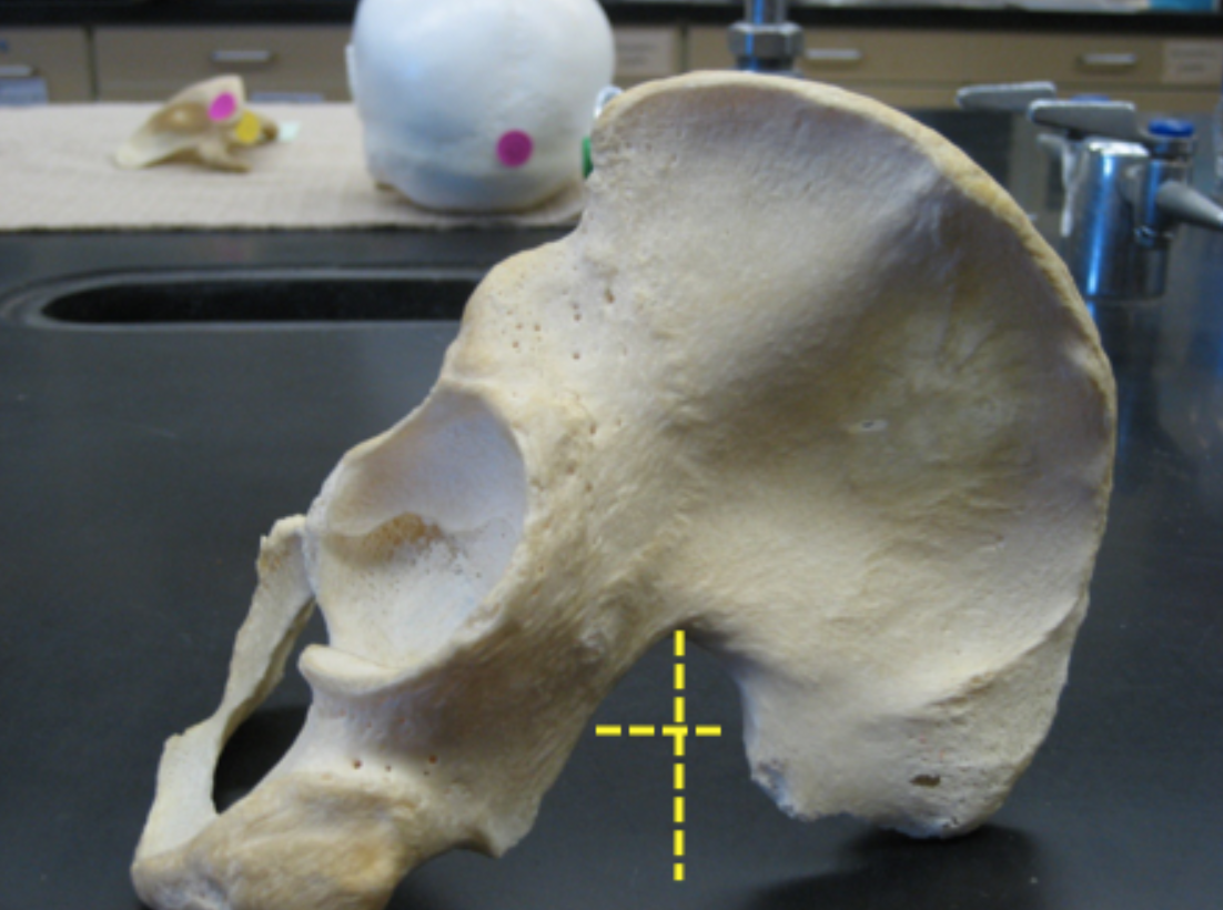 <p><span>Look at the greater sciatic notch, is this os coxa male? Answer Yes for male, No for female.</span></p>