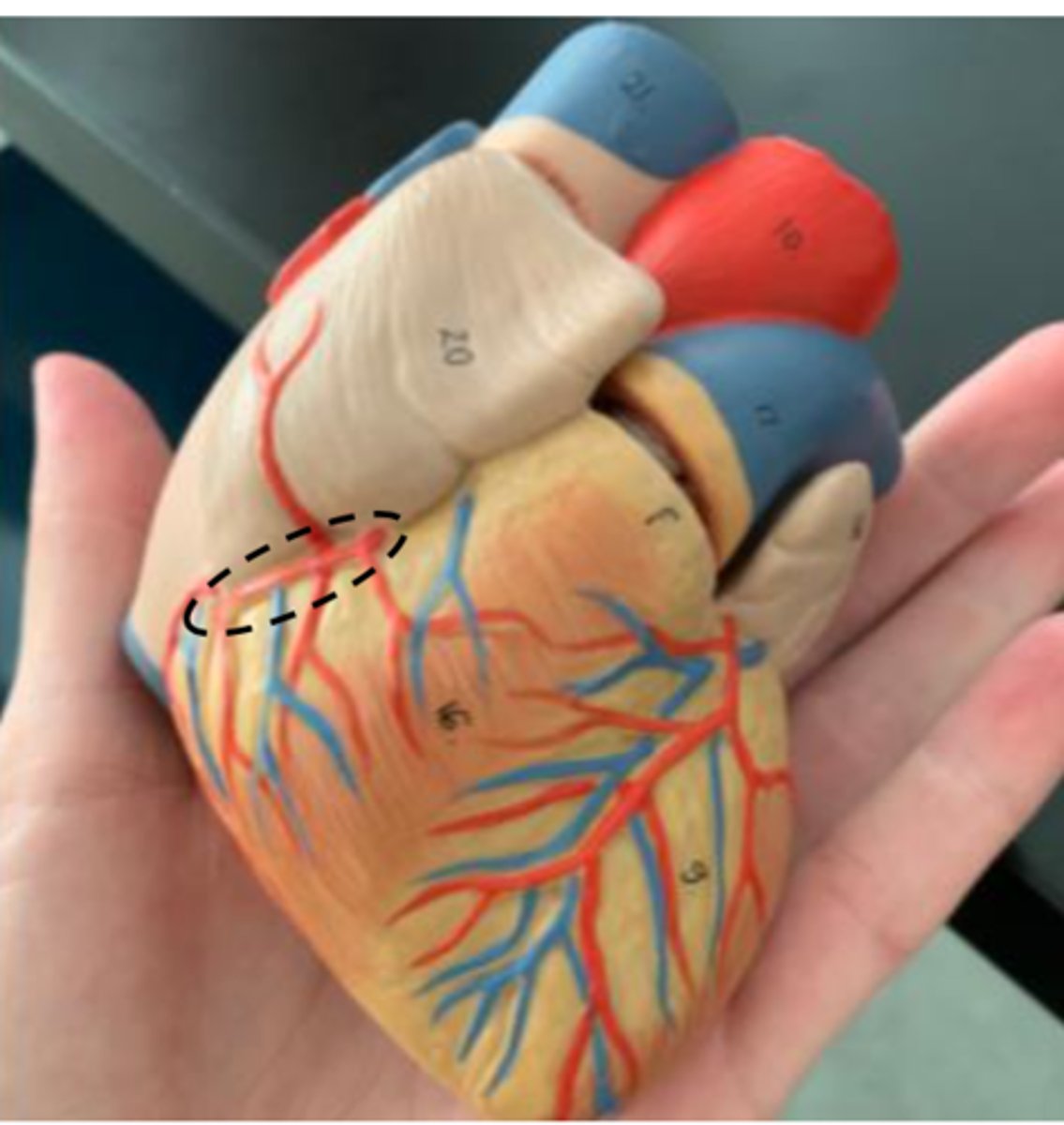 <p>Abbreviation = RCA</p>